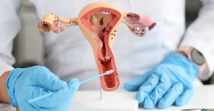 Papanicolaou (citología cervical)